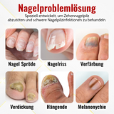 1+1 Gratis |  NailSaver™ Onychomykose Rapid Relief Öl