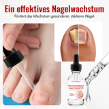 1+1 Gratis |  NailSaver™ Onychomykose Rapid Relief Öl