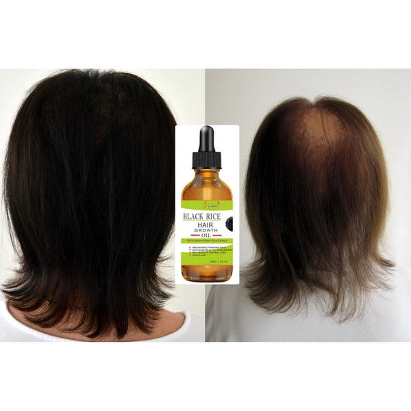 DarkRice Hair Growth Formula